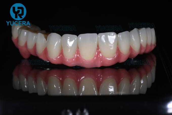 VHF Amann Arum 치과 밀링 Burs CAD CAM 밀링 커터 0.6mm 2.0mm 2.5mm 8