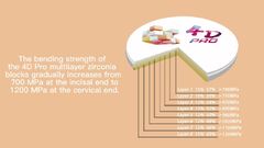 유세라 3D 플러스 다층 지르코니아 블록과 4D 프로 다층 지르코니아 블록의 차이점은 무엇입니까?