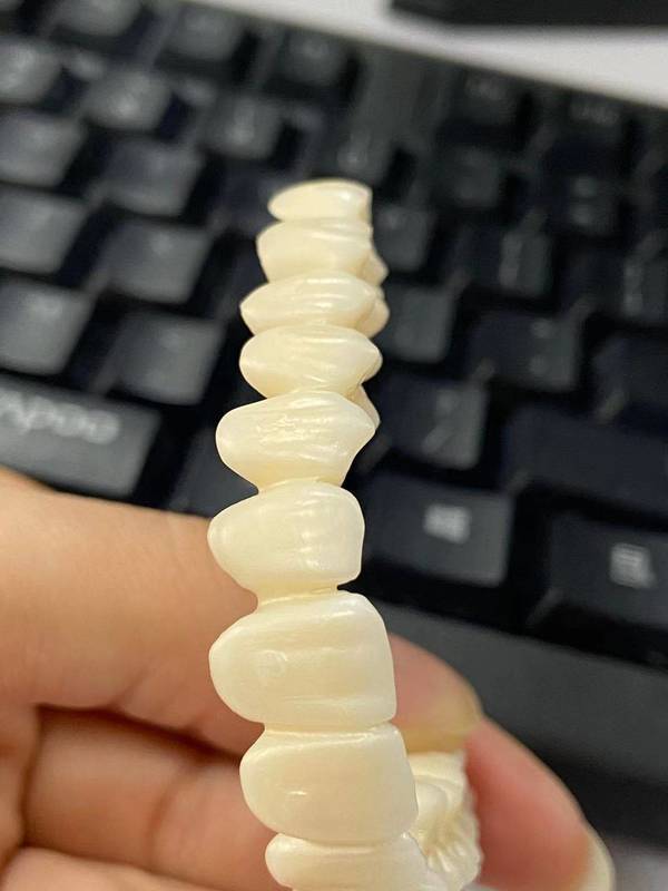 YUCERA 95mm HT 고투명 CAD CAM 치과 재료 제조업체 치과 실험실 소모품 지르코니아 블록 공장 가격