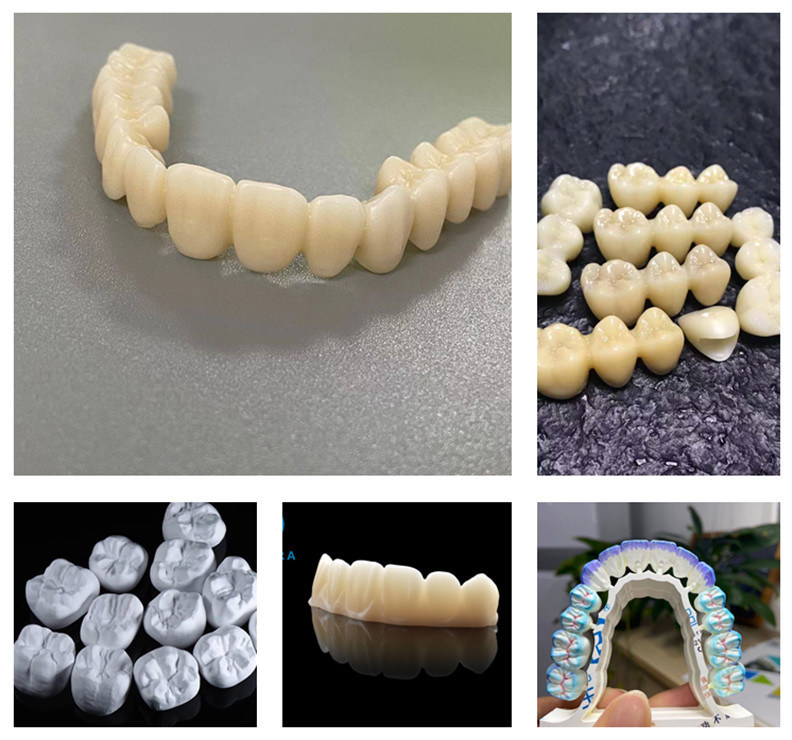 YUCERA 98mm HT 고투명 CAD CAM 치과 재료 제조업체 치과 실험실 소모품 지르코니아 블록 공장 가격