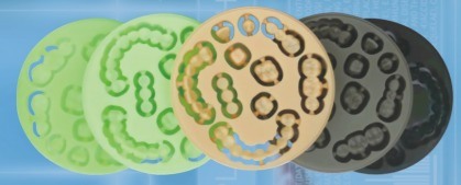 Yucera 고품질 PMMA 디스크, 치과 기공소용 OEM 서비스 치과 재료