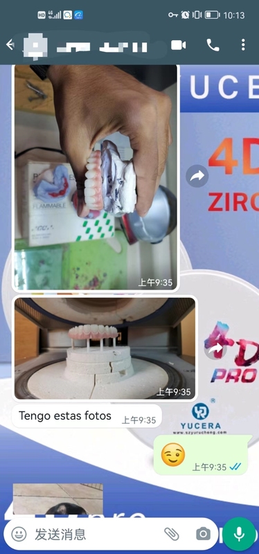 Yucera 4D Pro High - 투명도 및 고휘도 치과용 지르코니아 세라믹 블록, 실제 치아와 유사