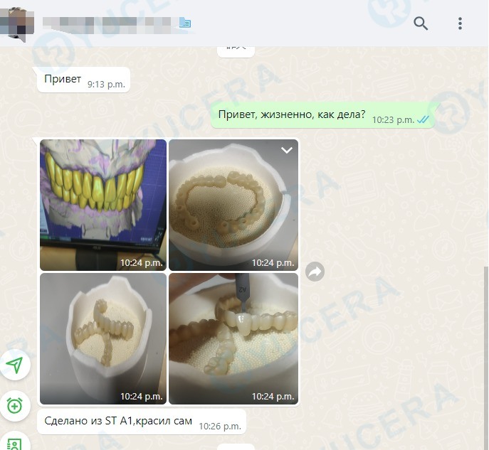 Yucera 4D Pro 95mm 치과용 지르코니아 블록, 다양한 치과 수복 솔루션에 적합한 정밀 치수