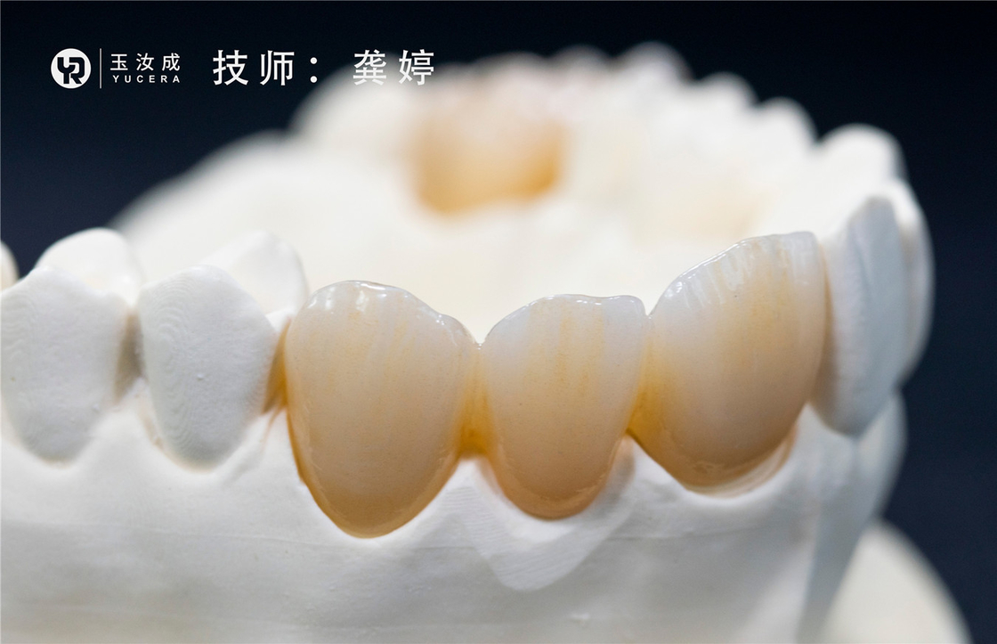 유세라 3D 이상 멀티라르 산화 지르코늄은 뒤 크라운을 위한 98x16mm 공개 시스템을 차단합니다