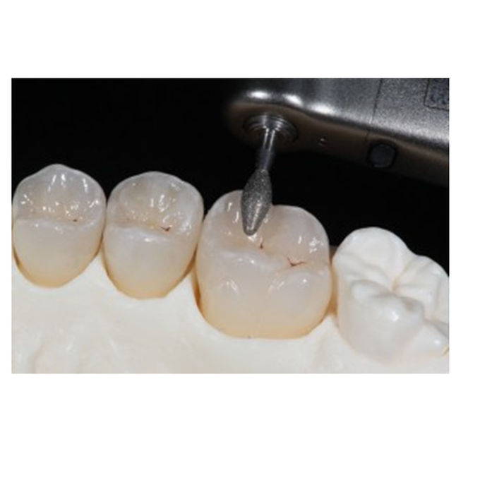 VHF Amann Arum 치과 밀링 Burs CAD CAM 밀링 커터 0.6mm 2.0mm 2.5mm 1